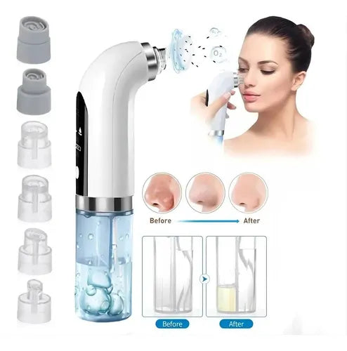 YANG Aqua - Extractor puntos negros de succión con agua